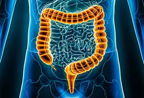 Colorectal Surgery