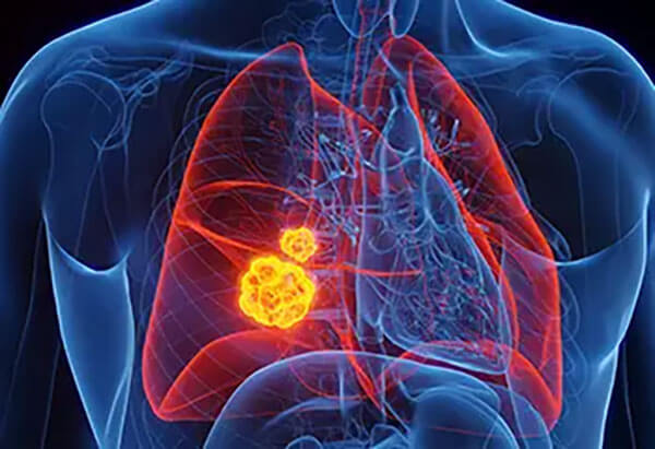 Surgical Oncology