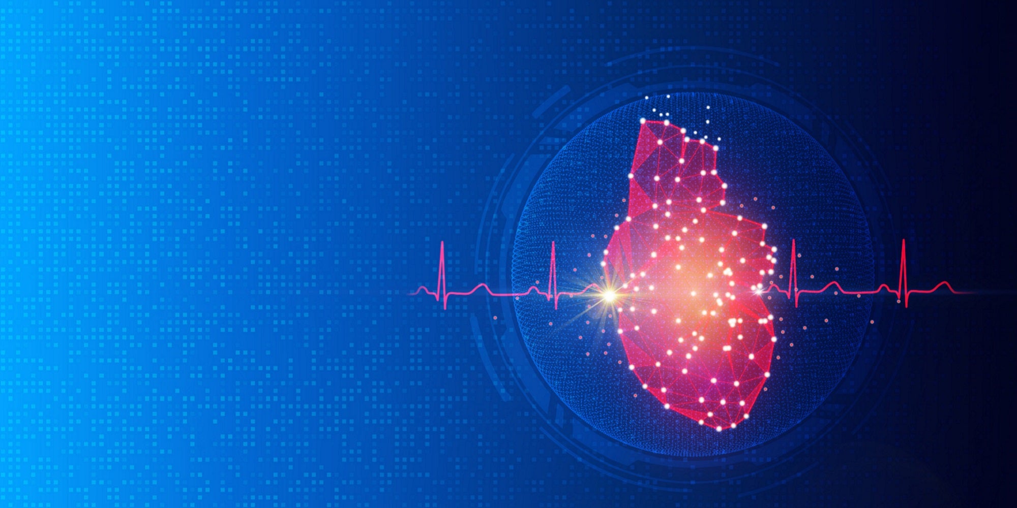 electrophysiology, electrophysiology cardiology, heart rhythm problems, stereotaxis