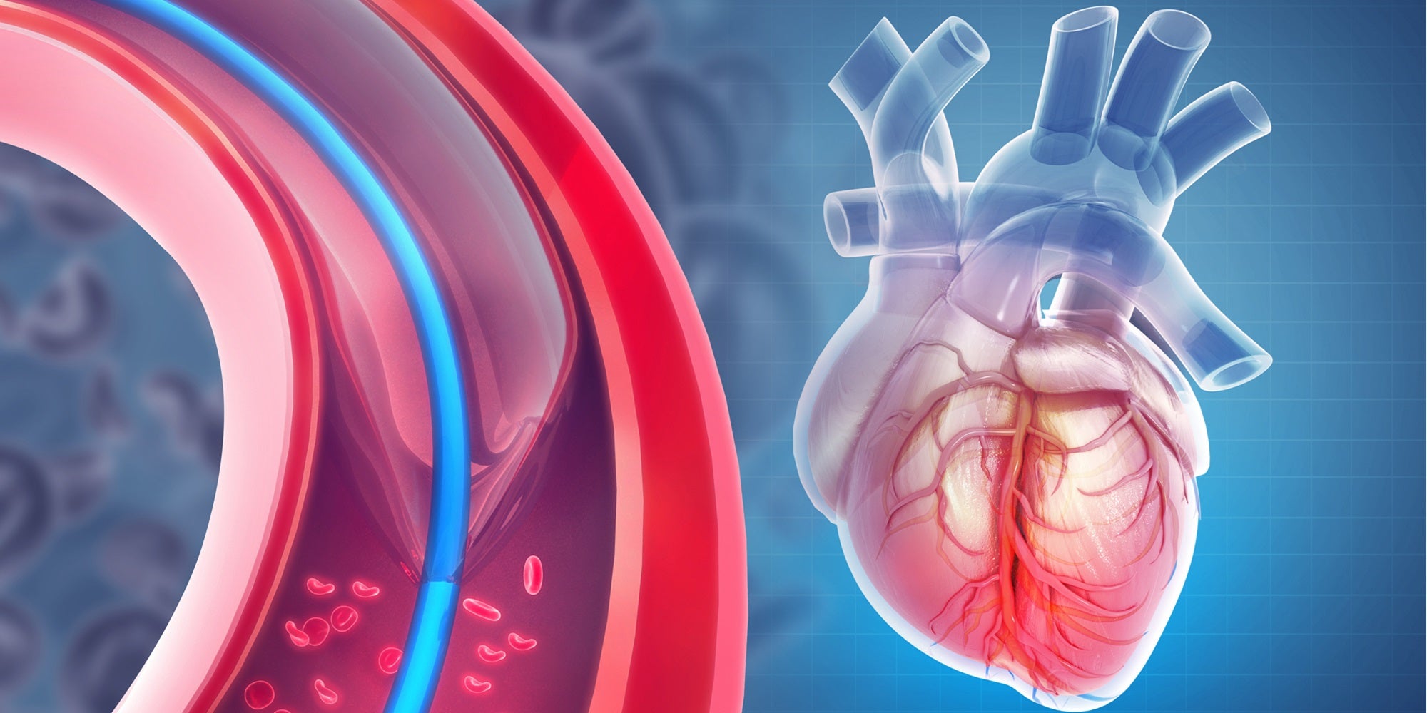 Interventional Cardiology