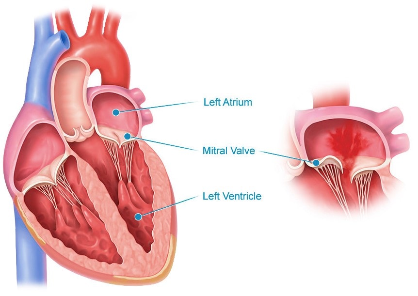 atrial septal defects, aortic stenosis, structural heart, atrial septal defects, structural heart program