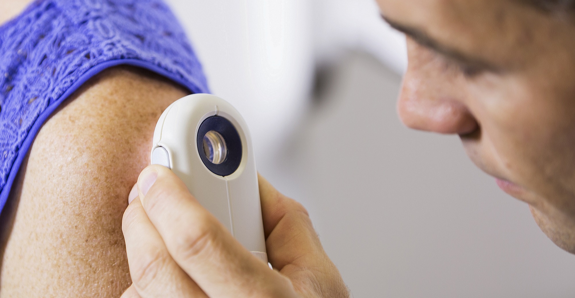 Community Skin Screening